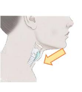Điền vào chỗ trống:  … hầu (ảnh 1)