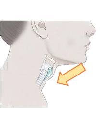  Điền vào chỗ trống: … hầu (ảnh 1)