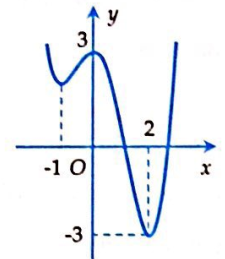 Cho hàm số \(y = f\left( x \right)\) xác định trên khoảng \(\left( { - \infty ; + \infty } \right)\) có đồ thị như hình vẽ dưới đây.Mệnh đề nào sau đây đúng? (ảnh 1)