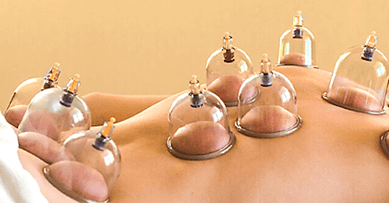 Một lọ giác hơi chứa không khí (xem là khí lí tưởng) được hơ nóng rồi úp nhanh lên da bệnh nhân. Nhiệt độ và áp suất của khối khí trong lọ khí đó lần lượt là 600 K và 1,00.105 Pa. Sau một thờ (ảnh 1)
