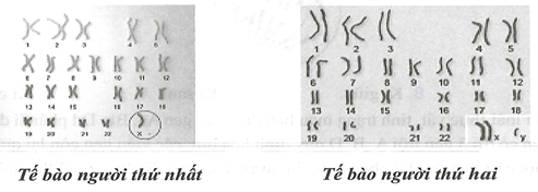 Đây là hai ảnh chụp bộ nhiễm sắc thể bất thường ở hai người (ảnh 1)