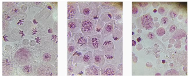 Kết quả a) Kết quả thực hành: làm và quan sát tiêu bản quá trình nguyên phân của tế bào (ảnh 2)