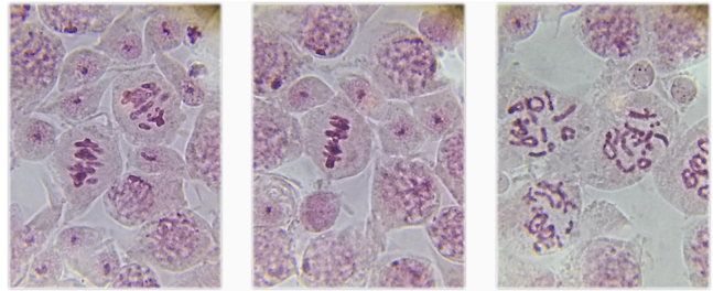 Kết quả a) Kết quả thực hành: làm và quan sát tiêu bản quá trình nguyên phân của tế bào (ảnh 3)