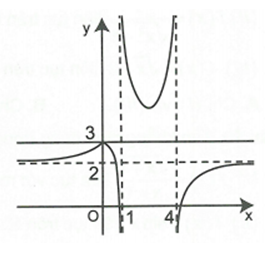 Cho hàm số  f(x)  có đồ thị như hình bên. Chọn khẳng định đúng.   (ảnh 1)