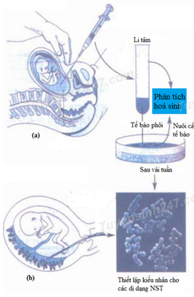 Hình bên dưới mô tả về các biện pháp sàng lọc trước sinh ở người. I. Đây là hai hình thức xét nghiệm trước sinh phổ biến: chọc dò dịch ối - hình (a) (ảnh 1)