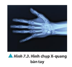 Tìm hiểu và giải thích vì sao khi sử dụng tia X để chụp ảnh trong y khoa như Hình 7.3, ta có thể thấy được xương của bàn tay.   (ảnh 1)