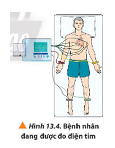 Trong máy đo điện tim, các điện cực được sử dụng để đo hiệu điện thế giữa các điểm khác nhau trên da của bệnh nhân, thường không vượt quá 1 mV đối với người bình thường (Hình 13.4). Đây là một phương pháp có độ nhạy cao để phát hiện sự bất thường của chức năng tim. Dựa vào sách, báo, intemet, các em hãy tìm hiểu và trình bày ngắn gọn nguyên lí hoạt động của máy đo điện tim.   (ảnh 1)