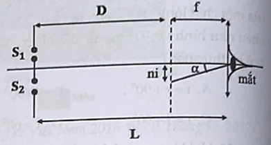 Trong thí nghiệm Young về giao thoa ánh sáng đơn sắc với bước sóng  , khoảng cách giữa hai khe là 1,0 mm. Vẫn giao thoa được quan sát qua một kính lúp có tiêu cự 5cm  (ảnh 1)