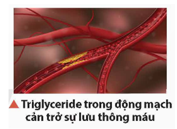 Triglyceride (chất béo) thuộc loại ester, là một lipid có trong cơ thể người. Nếu hàm lượng triglyceride trong máu (ảnh 1)