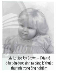 - Năm 1968, Robert Edwards đã cho thụ tinh thành công trứng người trong phòng thí nghiệm. Sau đó (ảnh 1)