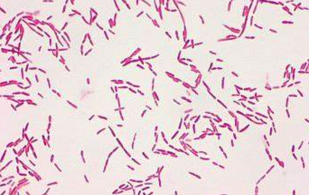 Chọn đáp án chính xác nhất Khi nghiên cứu 1 loài vi khuẩn Pseudomonas aeruginosa(trực khuẩn mủ xanh), gây các bệnh: nhiễm trùng vết thương, viêm tai ngoài, viêm kết mạc, viêm giác mạc, viêm phổi, nhiễm trùng tiểu, nhiễm trùng huyết,…, các nhà khoa học thực hiện nhuộm gram. Kết quả như hình dưới, theo em, vi khuẩn Pseudomonas aeruginosa thuộc loại vi khuẩn nào? (ảnh 1)