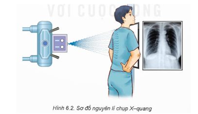 1. Nêu nguyên lí chụp X-quang trong y học. 2. Giải thích tại sao trên phim chụp X-quang lại có màu đậm, nhạt khác nhau. 3. Nêu một số ưu và nhược điểm của chụp X-quang. (ảnh 1)