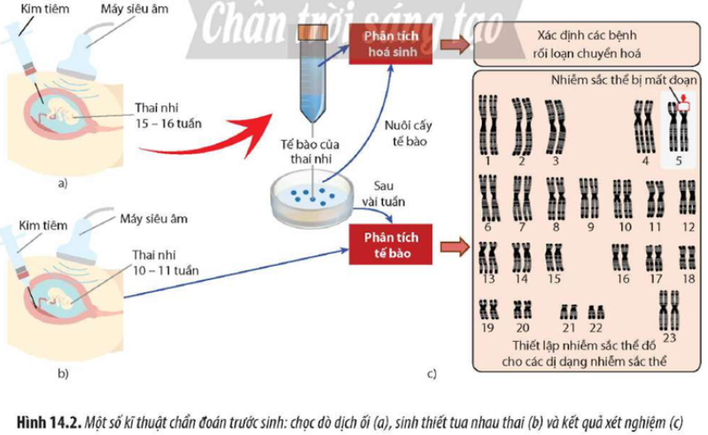 Quan sát Hình 14.2, hãy cho biết tại sao sử dụng kĩ thuật chẩn đoán trước sinh có thể  (ảnh 1)