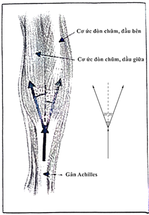 Cho hình vẽ về bó cơ của chân. Lực ở gân Achilles bằng bao nhiều nếu người chơi chỉ đứng bằng một chân? Coi tất cả các xương bàn chân là một khối cứng (hình B). Bỏ qua trọng lượng của xương bàn chân và g = 9,81m/s2 (ảnh 1)