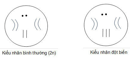 Từ sơ đồ kiểu nhân ở hình sau, hãy cho biết dạng đột biến số lượng nhiễm sắc thể nào đã xảy ra (ảnh 1)