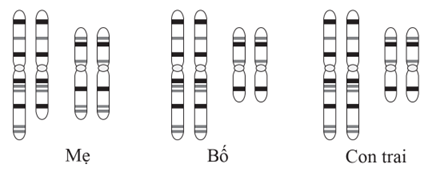 Phân tích bộ nhiễm sắc thể của cặp bố, mẹ và con trai thu được kết quả như hình dưới đây.  Từ kết quả thu được, phát biểu nào dưới đây là đúng? (ảnh 1)