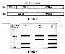 Gene B-globin quy định hình dạng hồng cầu có hai allele: Allele bình thường HbA và allele đột biến HbS. Khi phân tách hai allele này bằng enzyme đặc (ảnh 1)