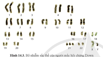 Quan sát hình 14.3 và cho biết biến đổi nào của nhiễm sắc thể gây ra hội chứng Down? (ảnh 1)