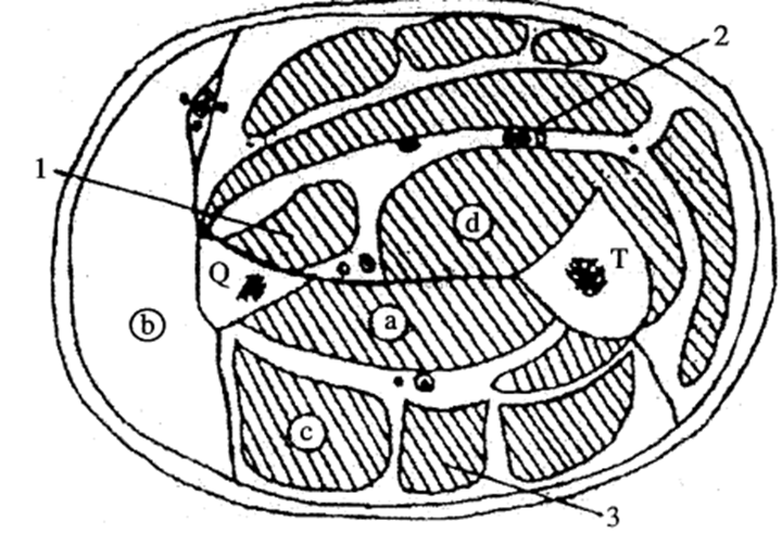  Chi tiết (2) trên hình vẽ là : (ảnh 1)