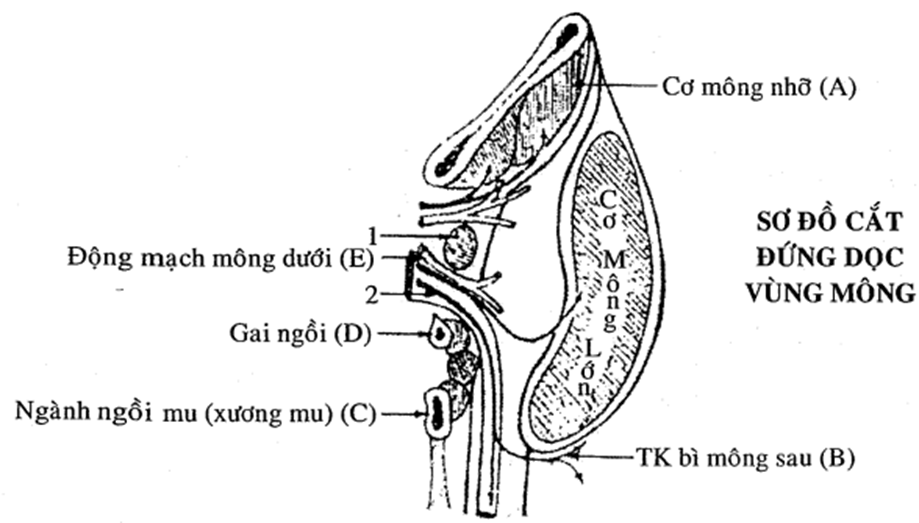  Trong các chi tiết được chú thích bằng chữ (A), (B), (C), (D), (E), chi tiết nào sai (ảnh 1)