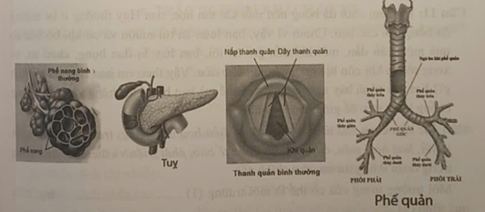 Hình ảnh cơ quan nào dưới đây không thuộc hệ hô hấp? (ảnh 1)