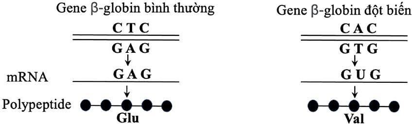 Quan sát hình và cho biết dạng đột biến gene gây bệnh này thuộc loại nào sau đây? (ảnh 1)