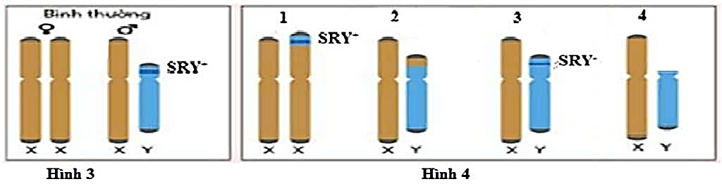 Người đó có thể có cặp NST nào trong số 4 cặp NST giới tính ở Hình 4? (ảnh 1)