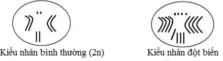 Từ sơ đồ kiểu nhân sau. Hãy cho biết dạng đột biến số lượng nhiễm sắc thể đã xảy ra?      	 (ảnh 1)