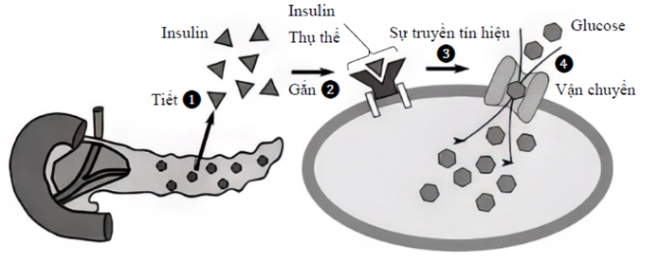 Hình a. miêu tả quá trình tiết insulin và cơ chế insulin làm tăng hấp thu glucose vào tế bào. Cơ chế này gồm bốn bước được biểu diễn bởi 4 số được đánh dấu tròn từ 1 đến 4 . Bốn bệnh nhân E, F, G và H mỗi người bị rối loạn tại một bước, tương ứng là bước 1, 2, 3, 4 trong quá trình gồm bốn bước này. Có hai test kiểm tra cho những bệnh nhân này.  - Test 1: Tách tế bào cơ từ mỗi bệnh nhân và tỉ lệ phần trăm tế bào gắn với insulin ở các nồng độ insulin khác nhau được xác định (Hình b).  - Test 2: Mỗi bệnh nhân được tiêm một lượng insulin tương ứng với khối lượng cơ thể và nồng độ glucose máu của họ được đo tại các thời điểm khác nhau sau khi tiêm (Hình c).  Hình a. Quá trình tiết insulin và cơ chế insulin làm tăng hấp thu glucose vào tế bào     Hình b. Tỉ lệ phần trăm tế bào gắn với insulin ở các nồng độ insulin khác nhau  	  Hình c. Nồng độ glucose trong huyết tương tại các thời điểm khác nhau  a) Đường 1 sự liên kết giữa insulin và thụ thể diễn ra bình thường ở bệnh nhân G.  b) Đường 2 và 3 tương ứng ghi kết quả của Test 1 và 2 của bệnh nhân F.  c) Đường 3 ghi kết quả kiểm tra của bệnh nhân E.  d) Đường 1 và 4 tương ứng ghi kết quả của Test 1 và 2 của bệnh nhân H. (ảnh 1)