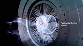 https://benhdotquy.net/wp-content/uploads/2022/07/Gamma-Knife-Radiosurgery.jpg