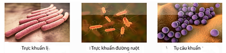 Trong các phát biểu sau, phát biểu nào đúng, phát biểu nào sai? (ảnh 1)