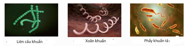 Trong các phát biểu sau, phát biểu nào đúng, phát biểu nào sai? (ảnh 1)