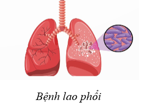 Trong các phát biểu sau, phát biểu nào đúng, phát biểu nào sai?   (ảnh 1)