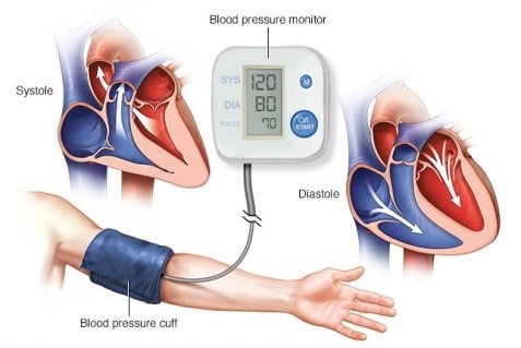 Tính liều lượng thuốc cần tiêm (đơn vị miligam) cho bệnh nhân để huyết áp giảm nhiều nhất. (ảnh 1)