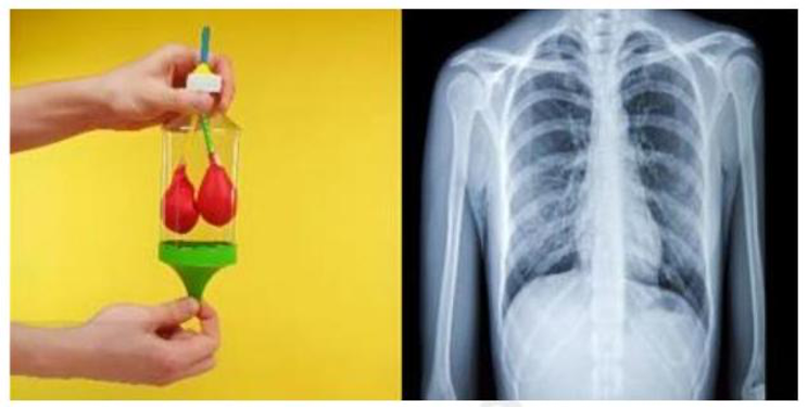 Một nhóm học sinh chế tạo mô hình phổi trong hệ hô hấp của người từ các dụng cụ: 1 vỏ chai nhựa có nắp đậy loại 1,0 lít hoặc 1,5 lít (ảnh 1)