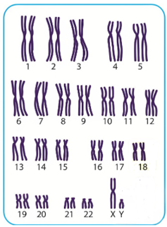 Hình vẽ mô tả bộ NST lưỡng bội ở loài A, mỗi mệnh đề sau là đúng hay sai? (ảnh 1)