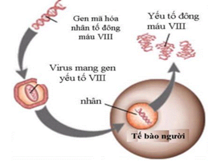 Một người bị bệnh máu khó đông do gene quy định tổng hợp một nhân tố đông máu bị đột biến (nhân tố đông máu VIII) (ảnh 1)