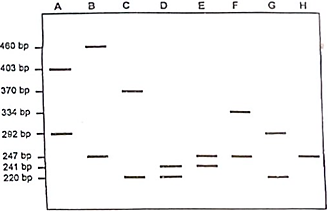 Bệnh Huntington là bệnh di truyền do gen đột biến trội trên NST thường gây ra. Các alen kiểu dại HD+ có chứa tối đa 35 lần lặp 3 nucleotide CAG ở vùng mã hóa của gen HD (CAG là bộ ba mã hóa glutamine), còn alen gây bệnh chứa từ 36 lần lặp CAG trở lên. (ảnh 1)