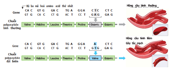 Hình dưới đây mô tả cơ chế phân tử của bệnh hồng cầu hình liềm. (ảnh 1)