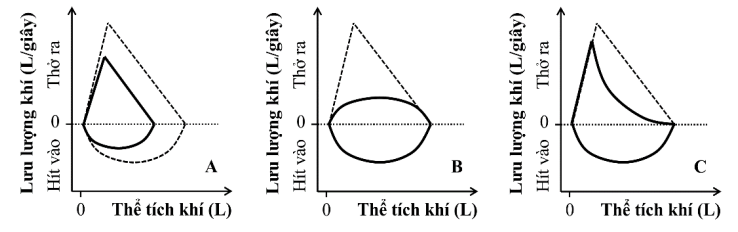 a) Một nhà khoa học tiến hành nghiên cứu trên hai nhóm người trưởng thành sống ở vùng cao (khoảng trên 3000m so với mực nước biển): nhóm dân địa phương A và nhóm dân nhập cư B mới sống khoảng 8 năm. (ảnh 1)