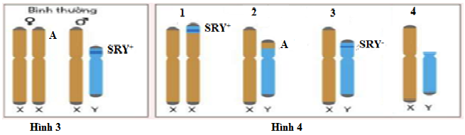 Ở người, trên cánh ngắn của NST Y có gene SRY (sex-determining region Y gene) quy định giới tính nam.  (ảnh 1)