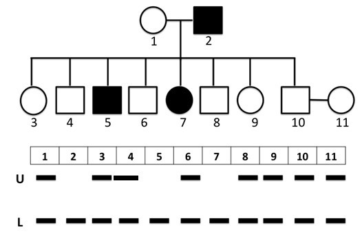 Phả hệ dưới đây cho thấy sự di truyền của một tính trạng bệnh X do 1 gen có 2 alen là U và L trên NST thường quy định.  (ảnh 1)