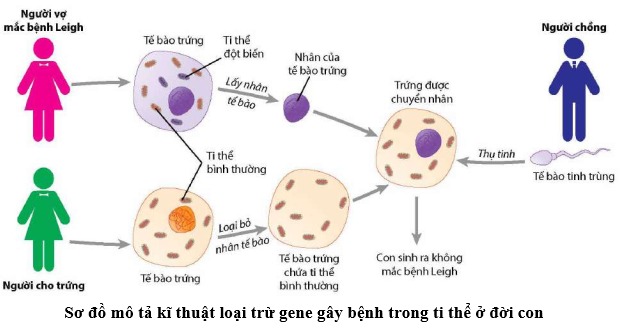 Bệnh Leigh – một bệnh di truyền hiếm gặp, gây thoái hóa hệ thần kinh sớm do gene nằm trong ty thể quy định.  (ảnh 1)