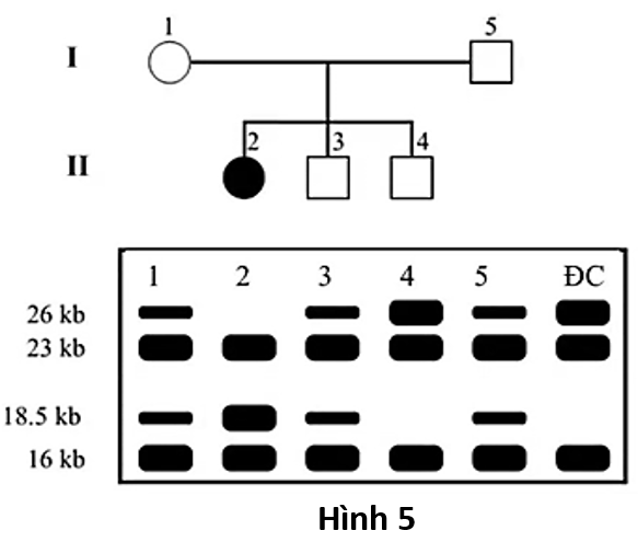 Phả hệ ở Hình 5 mô tả một gia đình có một người (người kí hiệu số 2) bị mắc chứng lùn bẩm sinh do giảm hàm lượng hormone tăng trưởng.  (ảnh 1)