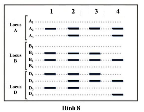 Hội chứng Down ở người là một bệnh di truyền gây ra do có ba nhiễm sắc thể (NST) số 21. Trên NST số 21 có ba locus gene A, B, D, trong đó locus A có 3 allele A1,  (ảnh 1)