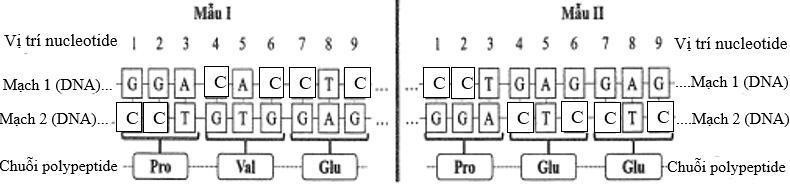 Ở người, xét một genee gồm hai allele: allele B mã hóa protein M1, không gây bệnh M; allele b mã hóa protein M2, gây bệnh M (ảnh 1)