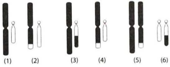 Một cặp vợ chồng đến tư vấn di truyền sau khi người vợ bị sảy thai liên tiếp và chưa sinh được người con nào. Khi phân tích bộ NST của cặp vợ chồng, người chồng bị chuyển đoạn giữa NST số 14 và NST số 21 (ảnh 1)