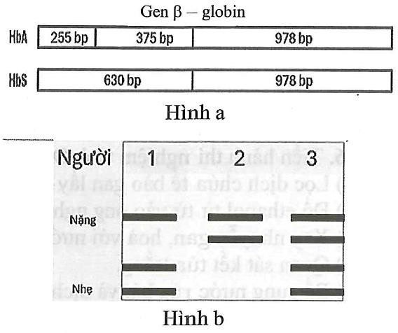 Gene 𝛽-globin quy định hình dạng hồng cầu có hai allele: Allele bình thường HbA và allele đột biến HbS. Khi phân tách hai allen này bằng enzyme đặc hiệu người ta thu được các đoạn DNA  (ảnh 1)