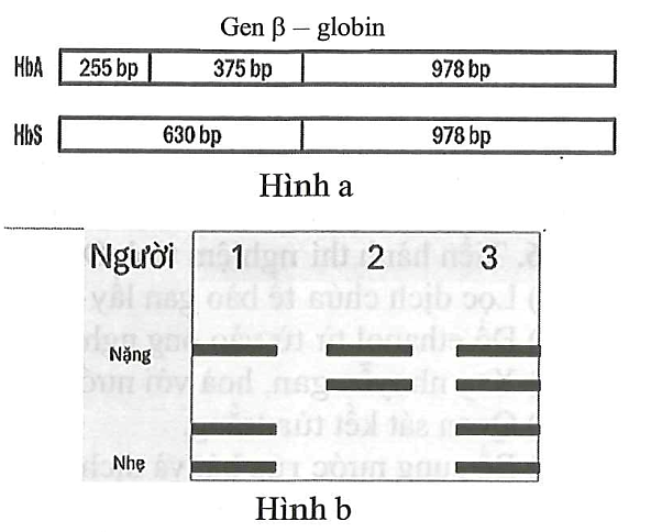 Gene β-globin quy định hình dạng hồng cầu có hai allele: Allele bình thường HbA và allele đột biến HbS.  (ảnh 1)