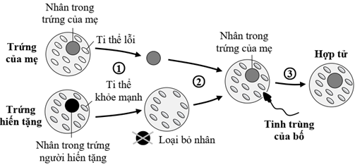 Bệnh tiểu đường ti thể là một loại bệnh tiểu đường đặc biệt do đột biến DNA ti thể gây ra (ti thể lỗi). Trong những năm gần đây, một phương pháp IVF thông qua thay thế nhân đã được đề xuất (ảnh 1)